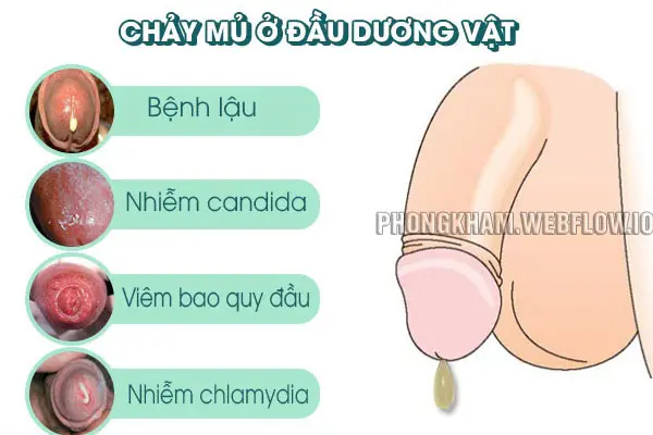 Chim bị chảy mủ: Nguyên nhân, triệu chứng và cách điều trị Gallery 2