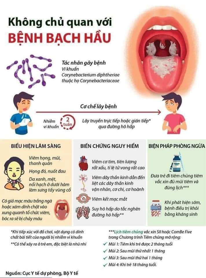 Bệnh bạch hầu là gì? Gallery 1