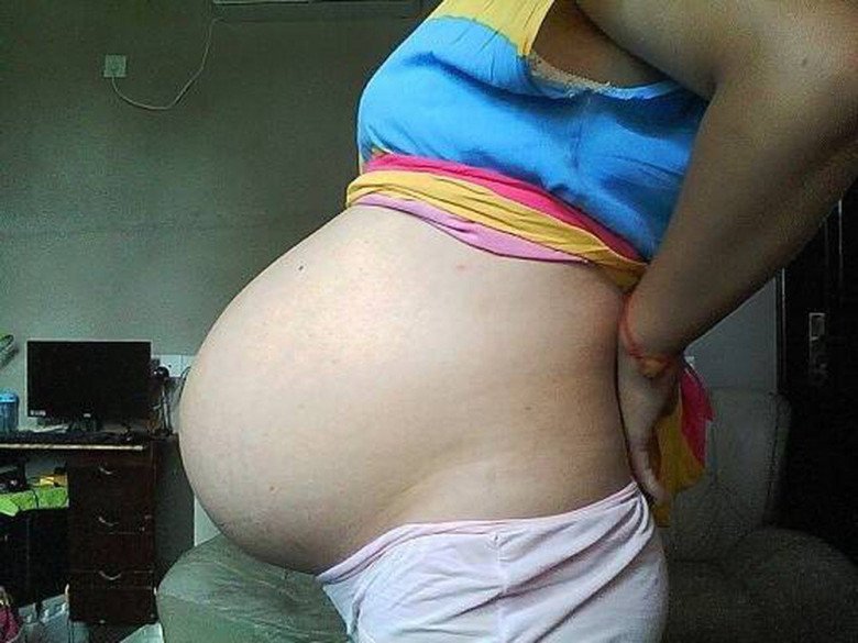 Bụng Tụt Là Như Thế Nào? Gallery 1
