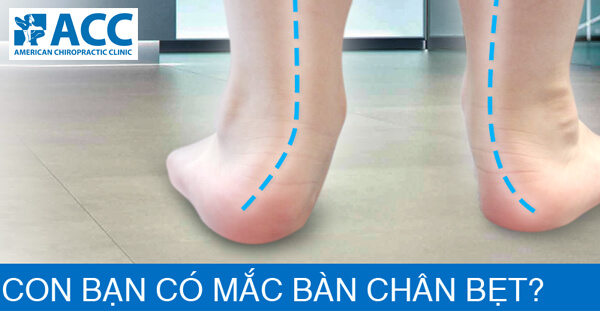Chân Bẹt Ở Trẻ Nhỏ: Nguyên Nhân, Triệu Chứng Và Cách Điều Trị Gallery 2