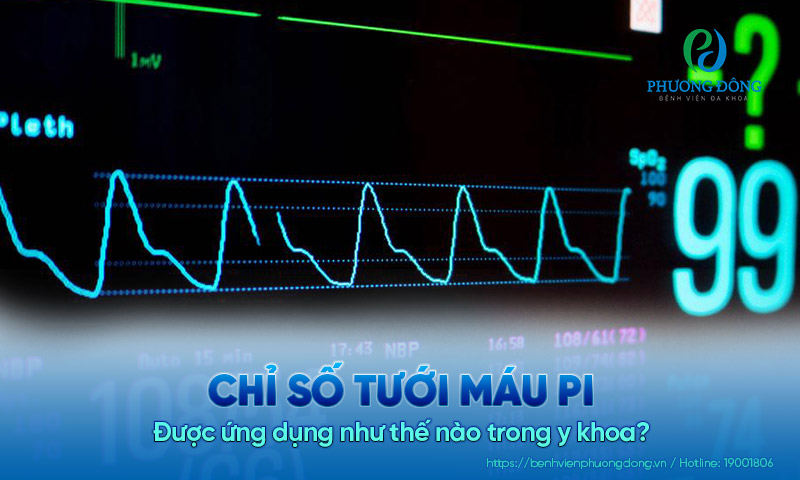 Chỉ số tưới máu PI thấp Gallery 2