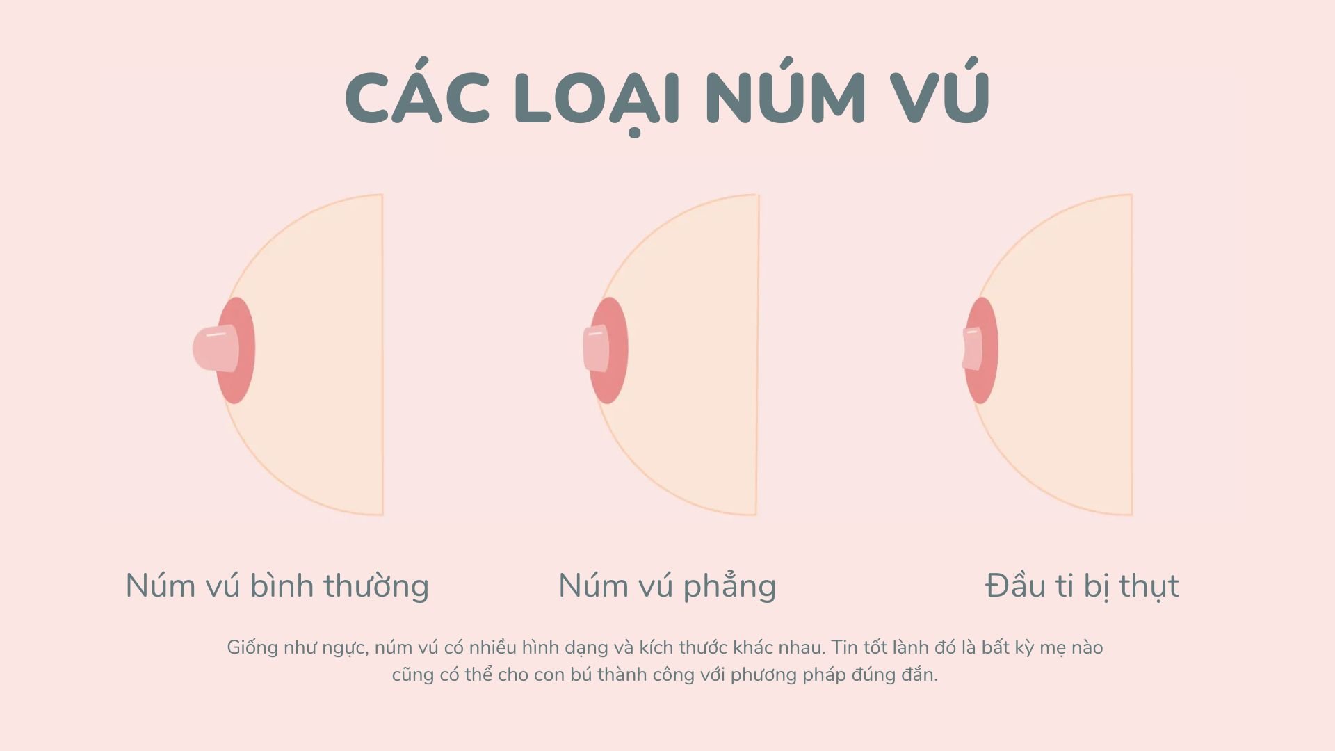 Đầu Ti Bị Thụt: Nguyên Nhân, Triệu Chứng Và Cách Khắc Phục Gallery 2