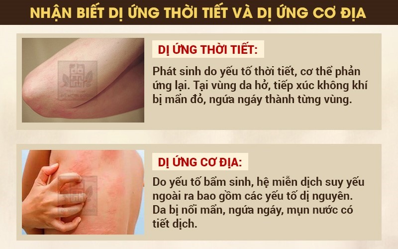 Dị ứng thời tiết lạnh nổi mẩn đỏ Gallery 2