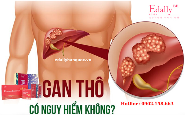Gan cấu trúc thô là gì? Gallery 2