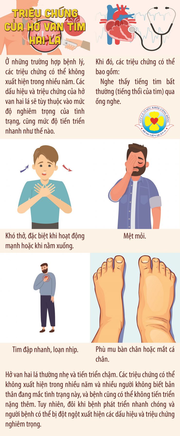 Hở Van Tim Là Gì? Gallery 2