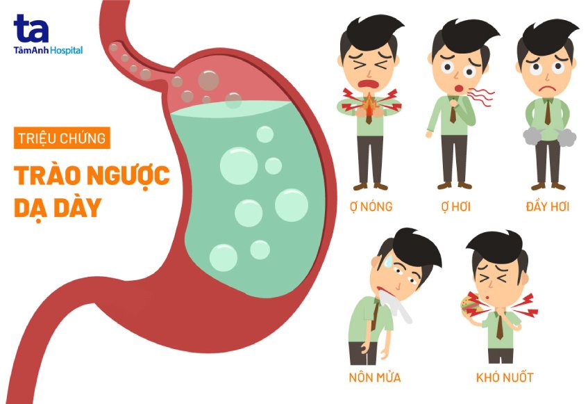 Hội chứng trào ngược là gì? Gallery 2