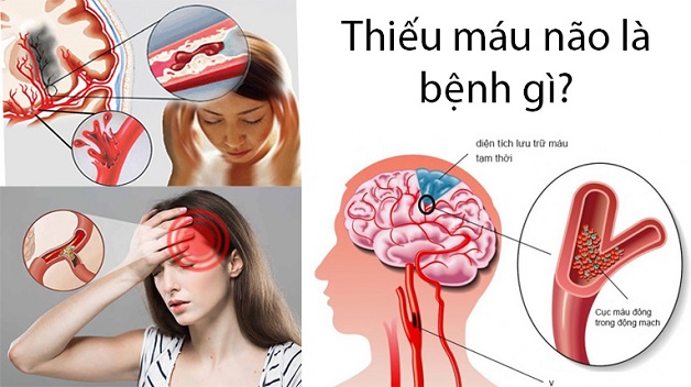 Chứng Mất Ngủ Về Đêm: Nguyên Nhân, Triệu Chứng Và Cách Khắc Phục Gallery 2