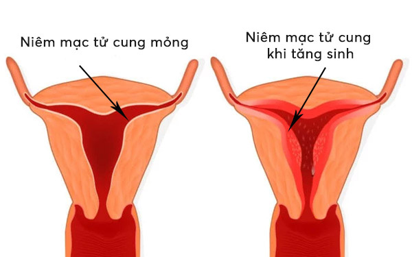 Niêm mạc mỏng là gì? Gallery 2