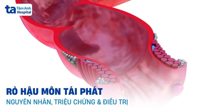 Phát Rồ Là Gì? Gallery 2