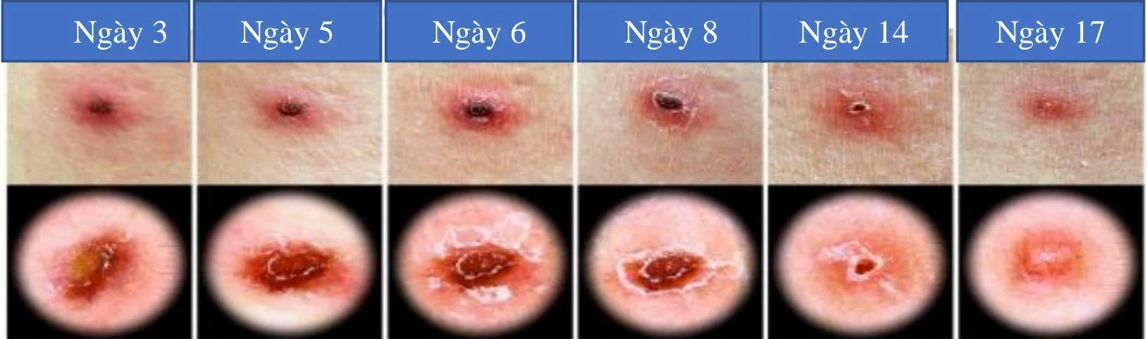 Sót Thương Là Gì? Nguyên Nhân, Triệu Chứng Và Cách Điều Trị Gallery 2