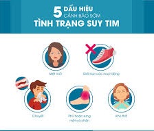 Bài Giảng Suy Tim: Hiểu rõ nguyên nhân, triệu chứng và cách điều trị Gallery 2