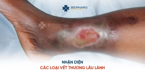 Vết Thương Chưa Lành Gallery 2
