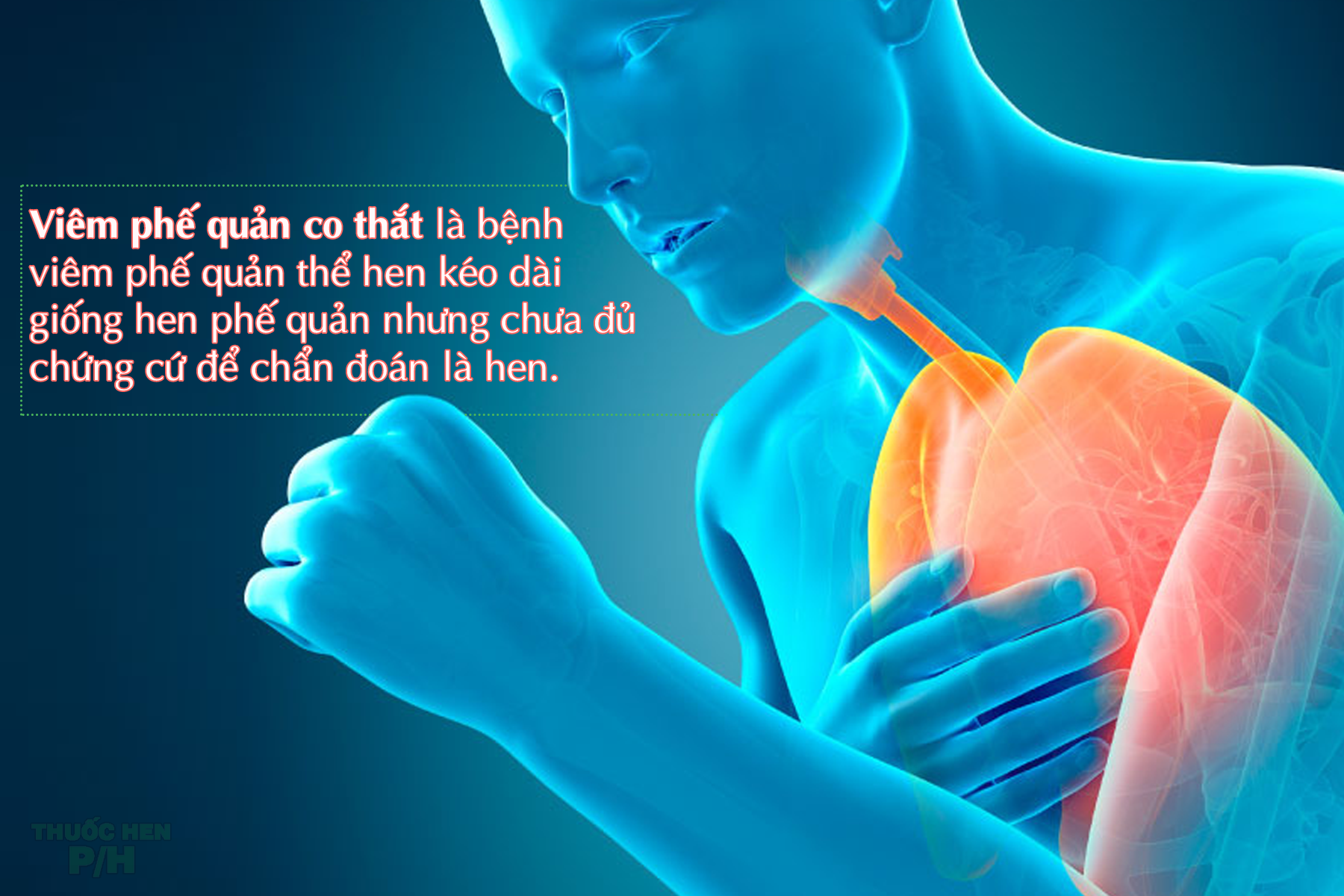 Viêm Phế Quản Co Thắt Gallery 1