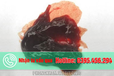 Kinh Nguyệt Màu Đen: Nguyên Nhân, Triệu Chứng và Cách Xử Lý Gallery 2