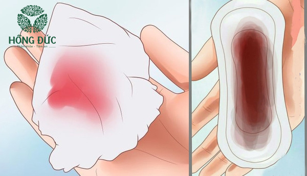Rỉ Máu Vùng Kín: Nguyên Nhân, Triệu Chứng Và Cách Xử Trí Gallery 2