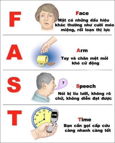 Đột Quỵ Là Gì? Triệu Chứng, Nguyên Nhân Và Cách Phòng Ngừa Gallery 1