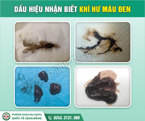 Khí hư có màu đen Gallery 2
