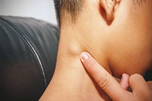 Nổi cục sau gáy: Nguyên nhân, triệu chứng và cách xử trí Gallery 2
