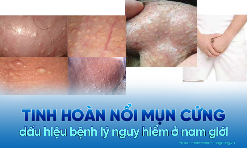 Mọc mụn ở chim: Nguyên nhân, triệu chứng và cách điều trị Gallery 2
