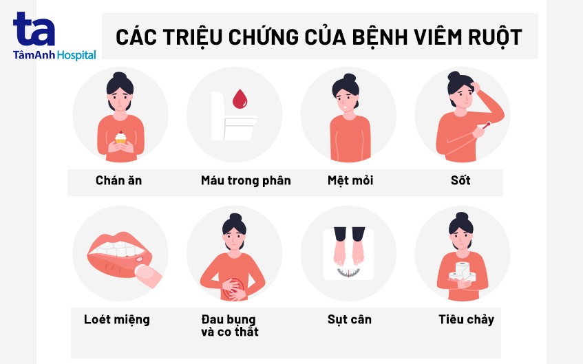 Sốt Ruột Gallery 2