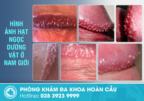 Hạt Cườm Dương Vật Gallery 2