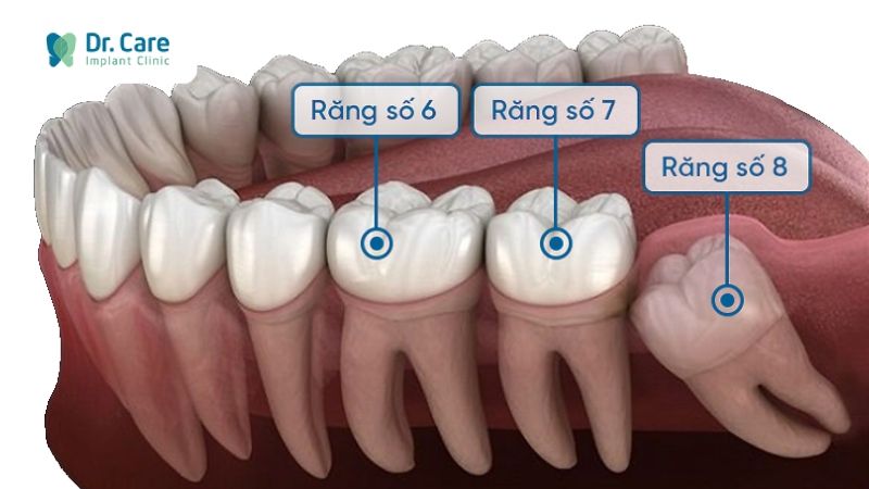 Trồng Răng Số 7 Hàm Dưới Bao Nhiêu Tiền? Gallery 2