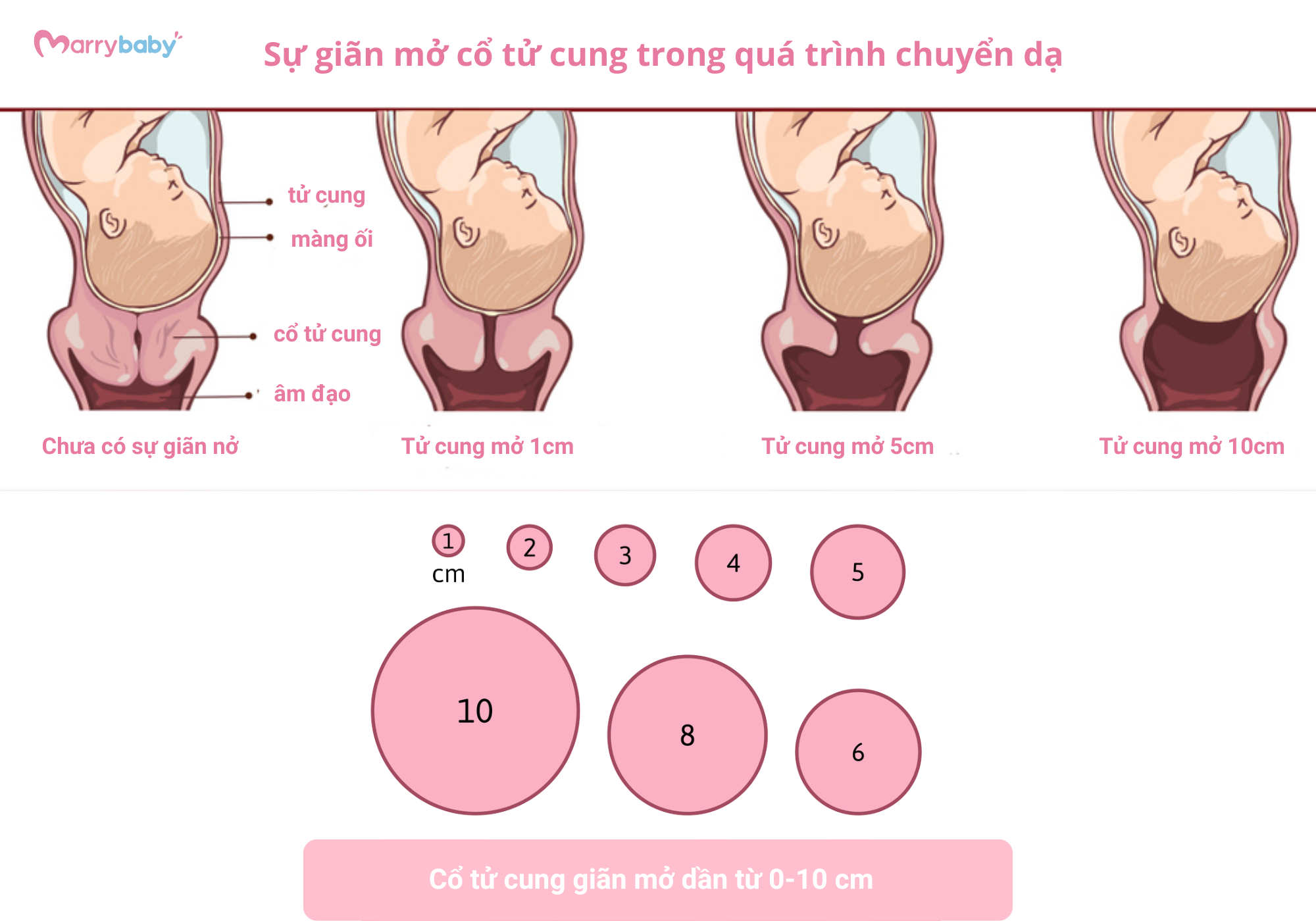 Tử Cung Mở 1cm Gallery 1