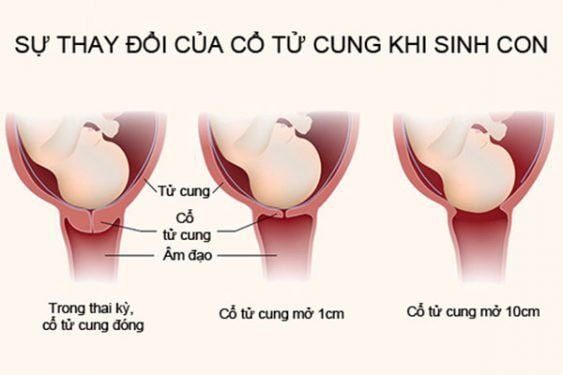 Tử Cung Mở 1cm Gallery 2