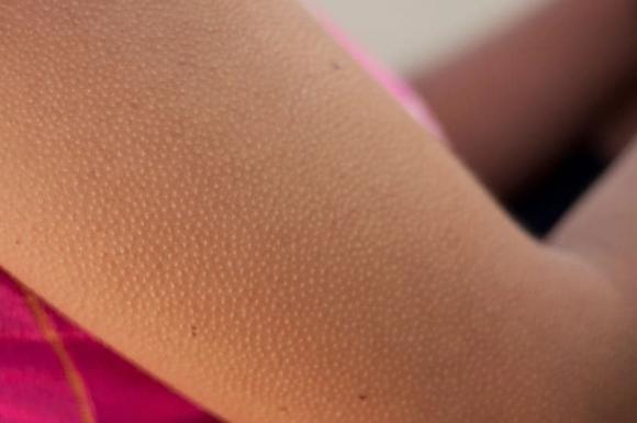 Tự Nhiên Nổi Da Gà Là Điềm Gì?