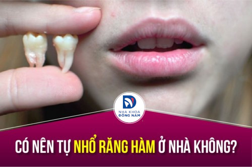 Tự Nhổ Răng Hàm