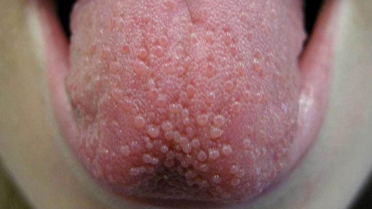 U Nhú Tiền Đình