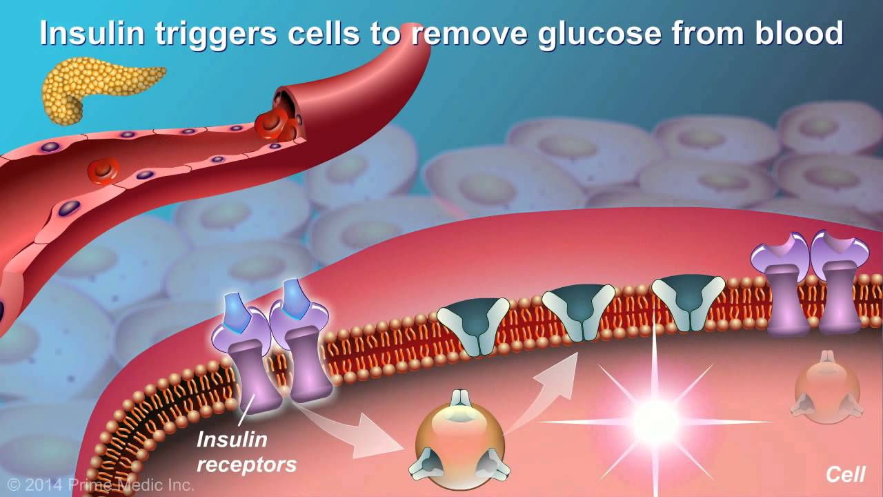 Diabetes in English Gallery 2