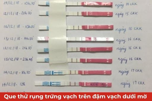 Vạch dưới đậm hơn vạch trên que thử thai: Có phải bạn đang mang thai?