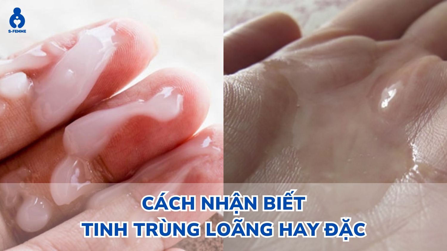 Cách Nhận Biết Tinh Trùng Loãng Hay Đặc Gallery 2