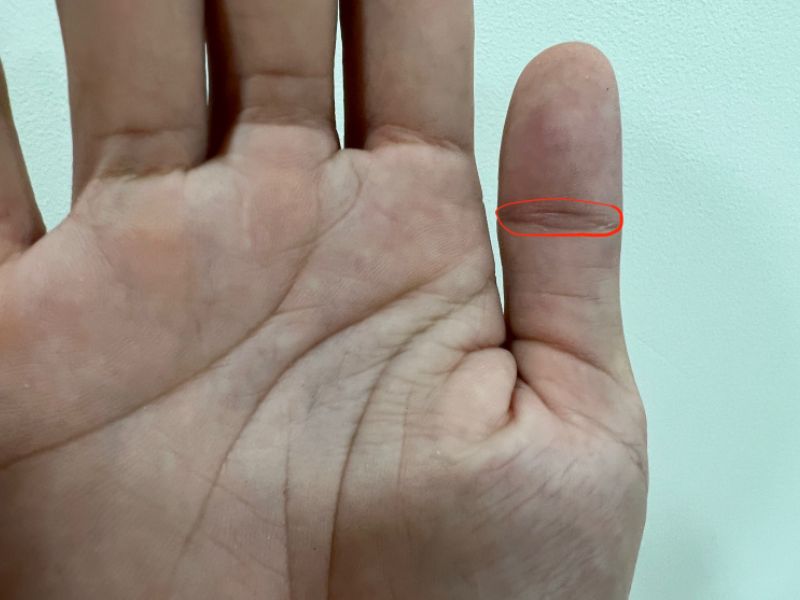 Vân Mắt Phượng Kép: Ý Nghĩa, Đặc Điểm Và Những Điều Thú Vị