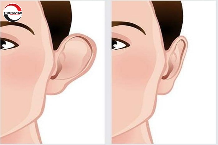 Tướng Tai Vểnh Ra Trước: Điềm Báo Gì Về Tính Cách Và Vận Mệnh? Gallery 2