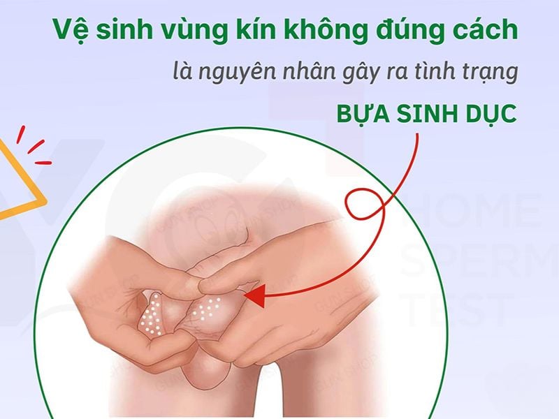 Cách Vệ Sinh Bựa Sinh Dục Gallery 1