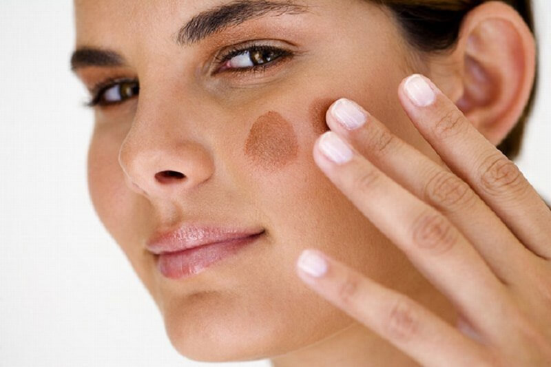 Vết Bớt Màu Nâu: Nguyên Nhân, Triệu Chứng và Cách Điều Trị