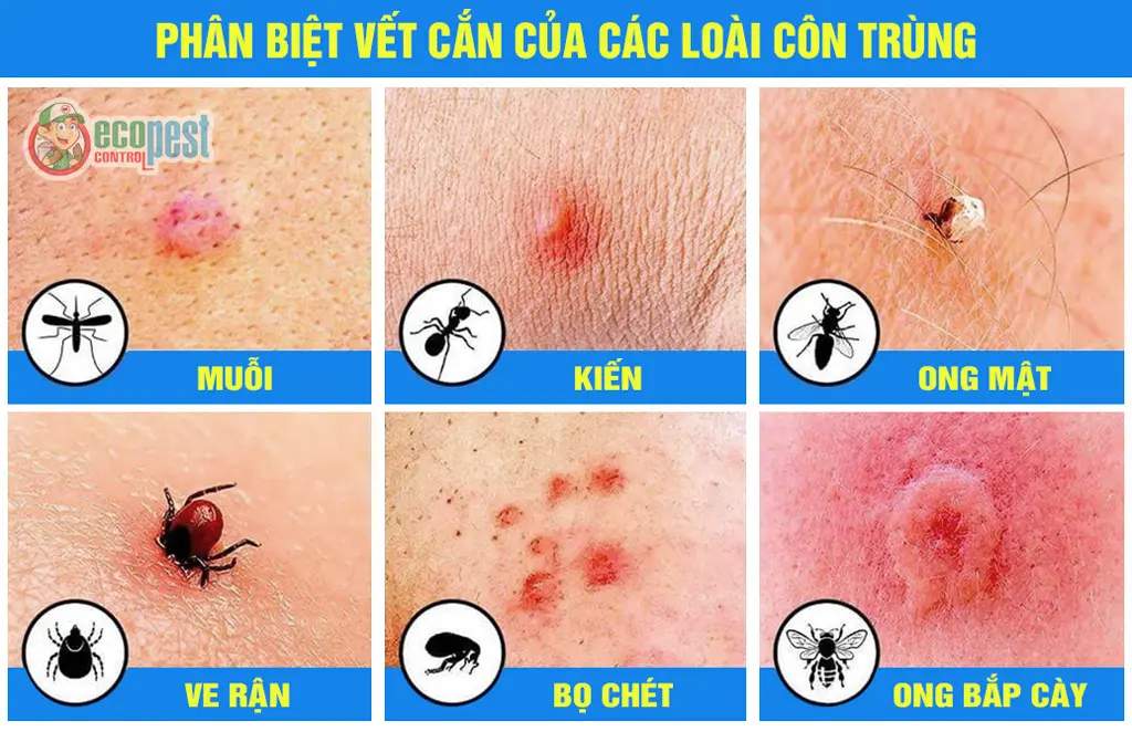 Con Bọ Nhảy Đốt Có Nguy Hiểm Không? Gallery 1