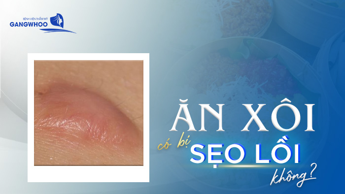 Vết thương lành rồi ăn xôi được không?