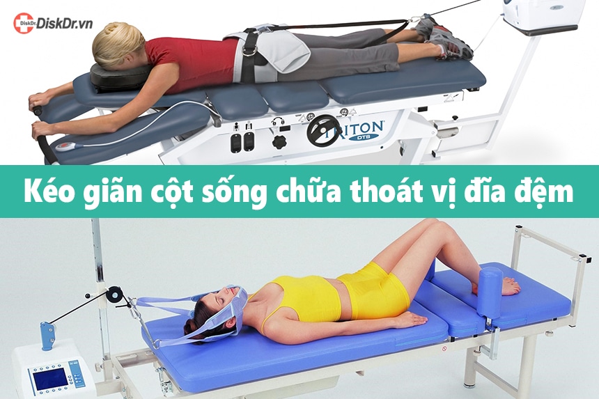 Kéo dãn hay kéo giãn? Gallery 2