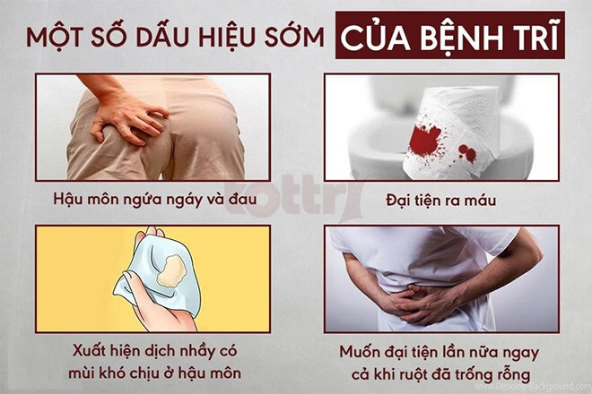 Vì Sao Bị Trĩ?