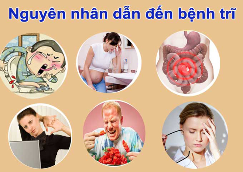 Vì Sao Bị Trĩ? Gallery 2