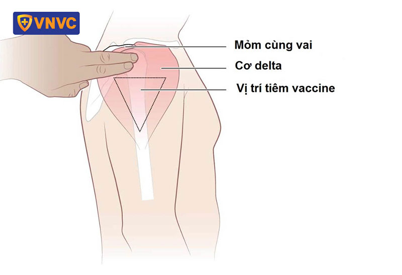 Tiêm phòng bại liệt ở tay hay chân? Gallery 1