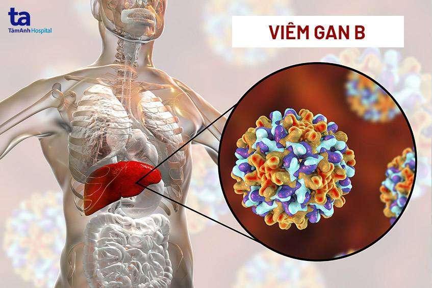 Viêm gan B và viêm gan siêu vi B có giống nhau không?