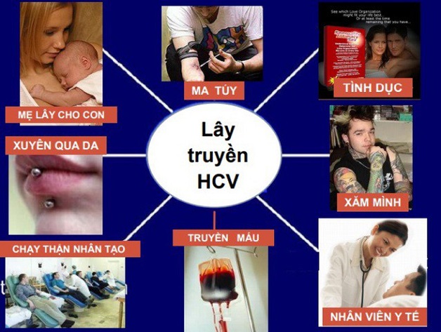 Viêm gan siêu vi C lây qua đường nào?