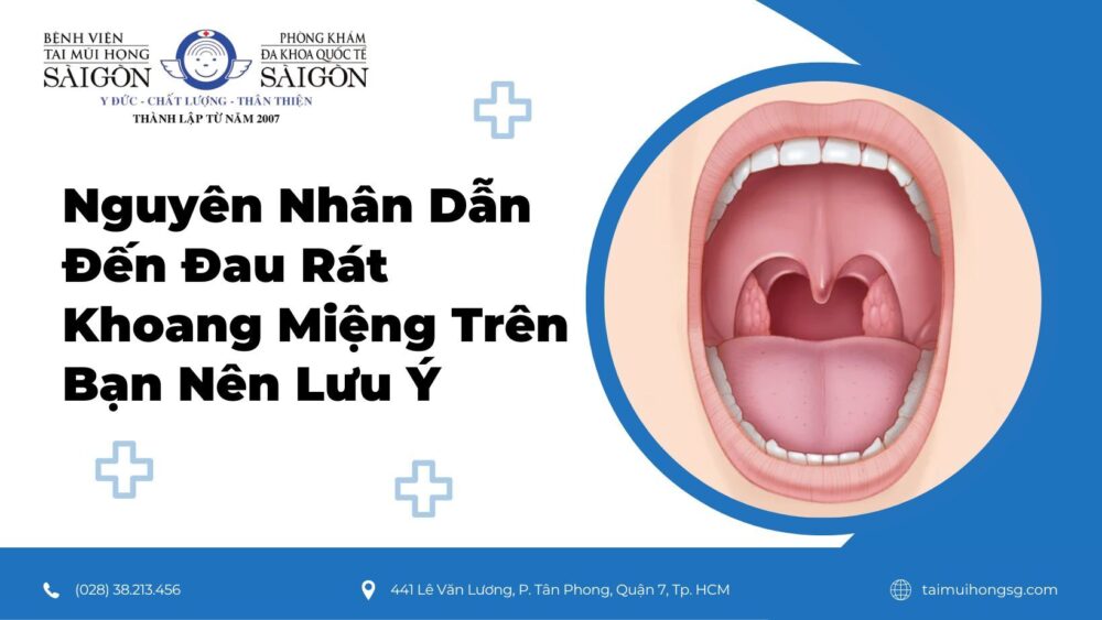 Vòm Miệng Trên Bị Rát: Nguyên Nhân và Cách Khắc Phục
