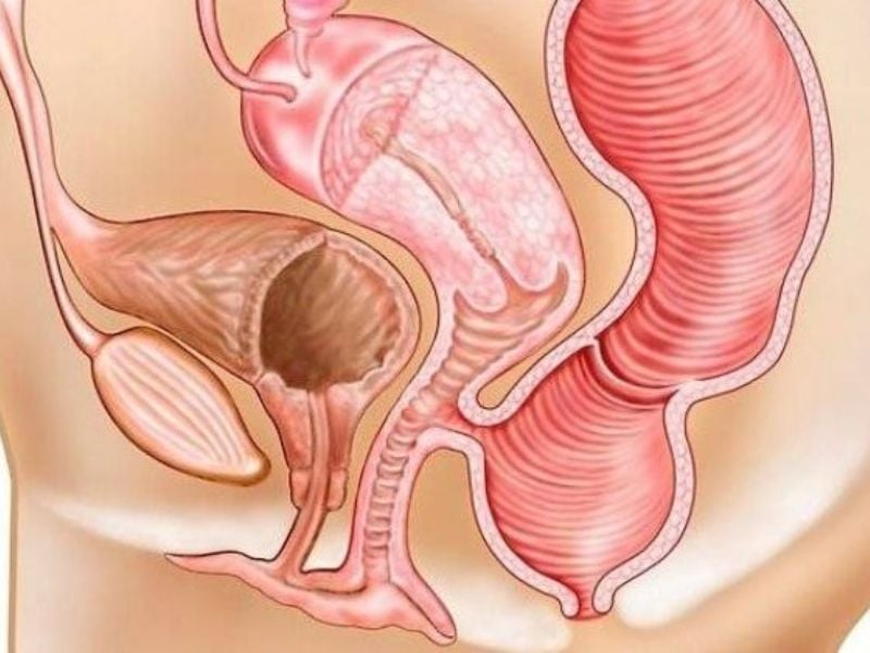 Vùng kín phát ra tiếng xì hơi