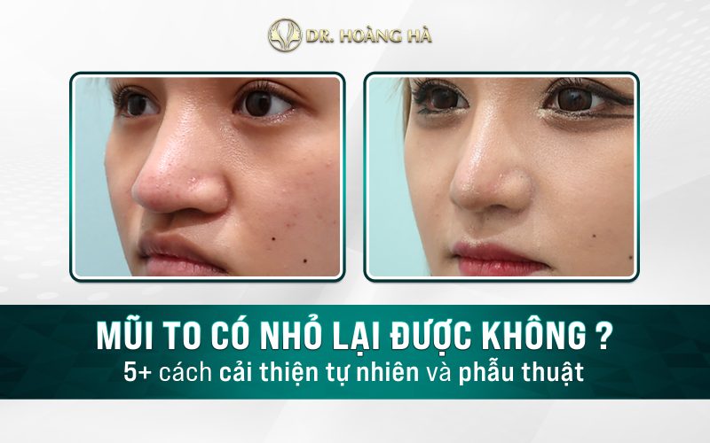 Vuốt mũi có làm mũi to? Gallery 2
