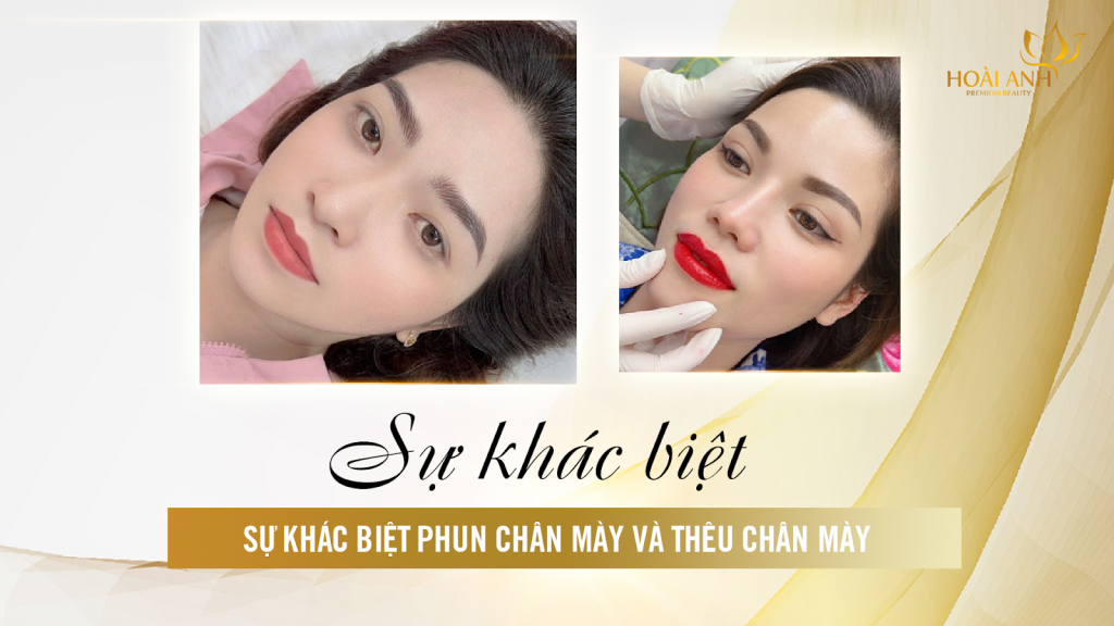 Xăm Chân Mày Hoài Anh
